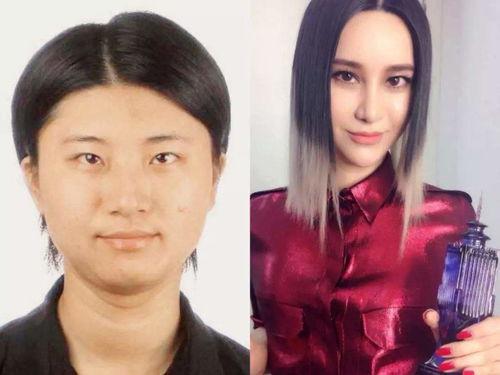 探索时刻明星整容,明星整容背后的真相与争议